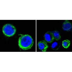 Tyrosine-Protein Kinase Receptor UFO (AXL) Antibody