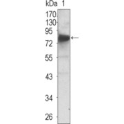 abx015713