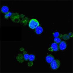 High Affinity Nerve Growth Factor Receptor (NTRK1) Antibody