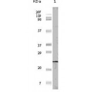 Western blot analysis using 4E-BP1 antibody against truncated 4E-BP1 recombinant protein (1).