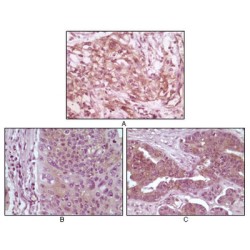 Eukaryotic Translation Initiation Factor 4E-Binding Protein 1 (4EBP1) Antibody