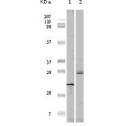 Western blot analysis using 4E-BP1 antibody against truncated 4E-BP1 recombinant protein (1) and A431 cell lysate (2).