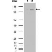 Western blot analysis using ABL2 antibody against HEK293T cells transfected with the pCMV6-ENTRY control (1) and pCMV6-ENTRY ABL2 cDNA (2).