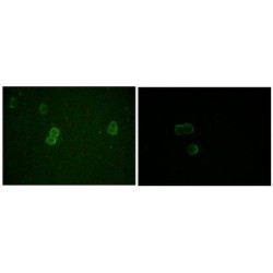 Apolipoprotein M (ApoM) Antibody