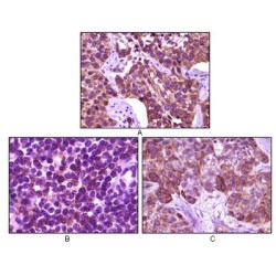 Tyrosine-Protein Kinase BLK (BLK) Antibody