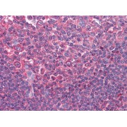 Immunohistochemical analysis of paraffin-embedded human Tonsil tissues using anti-CD80 mAb.