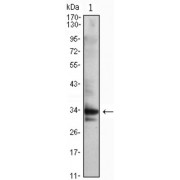 Western blot analysis using CDC2 antibody against Jurkat (1) cell lysate.