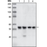 Western blot analysis using CHK1 antibody against A431 (1), Hela (2), NIH/3T3 (3) and K562 (4) cell lysate.
