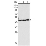 Western blot analysis using CK17 antibody against Hela (1), MCF-7 (2) and A431 (3) cell lysate.