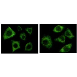 Cytokeratin (Pan) (CK-5) Antibody