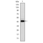 Western blot analysis using E7 antibody against human E7 (AA: 1-98) recombinant protein.
