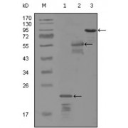 Western blot analysis using ERBB3 antibody against truncated Trx-ERBB3 recombinant protein (1), MBP-ERBB3 (aa1175-1275) recombinant protein (2) and truncated ERBB3 (aa665-1342) -hIgGFc transfected CH0-K1 cell lysate (3).