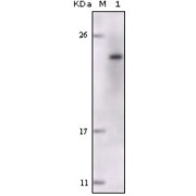 Western blot analysis using FES antibody against truncated FES recombinant protein.