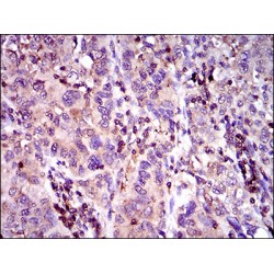 Multidrug Resistance-Associated Protein 4 (ABCC4) Antibody