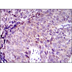 Multidrug Resistance-Associated Protein 4 (ABCC4) Antibody