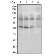 Western blot analysis using ABCG5 antibody against human ABCG5 recombinant protein. (Expected MW is 32.7 kDa).