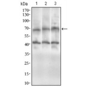 Western blot analysis using ABCG5 antibody against human ABCG5 recombinant protein. (Expected MW is 32.7 kDa).