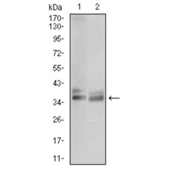 Tartrate-Resistant Acid Phosphatase 5 / TRACP5 (ACP5) Antibody