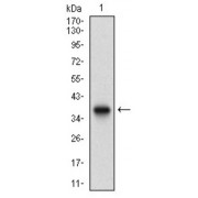 Western blot analysis using ACP5 antibody against human ACP5 recombinant protein. (Expected MW is 37.3 kDa).