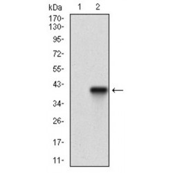 Tartrate-Resistant Acid Phosphatase 5 / TRACP5 (ACP5) Antibody