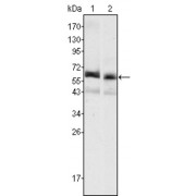 Western blot analysis using AFP antibody against HepG2 (1) and SMMC-7721 (2) cell lysate.