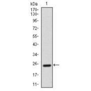 Western blot analysis using AlCAM antibody against Human ALCAM recombinant protein. (Expected MW is 26.3 kDa).