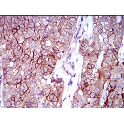 Activated Leukocyte Cell Adhesion Molecule / CD166 (ALCAM) Antibody