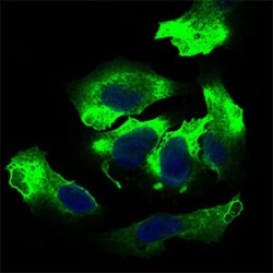 Activated Leukocyte Cell Adhesion Molecule / CD166 (ALCAM) Antibody