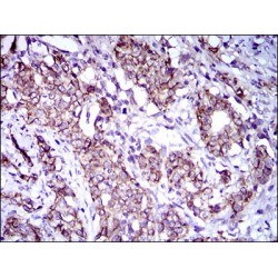 Activated Leukocyte Cell Adhesion Molecule / CD166 (ALCAM) Antibody