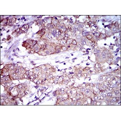 Activated Leukocyte Cell Adhesion Molecule / CD166 (ALCAM) Antibody