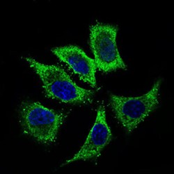 Aldehyde Dehydrogenase, Mitochondrial (ALDH2) Antibody