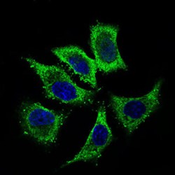 Aldehyde Dehydrogenase, Mitochondrial (ALDH2) Antibody