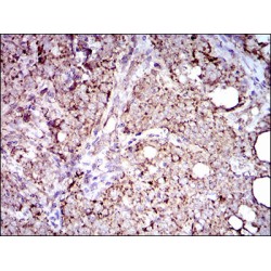 Aldehyde Dehydrogenase, Mitochondrial (ALDH2) Antibody