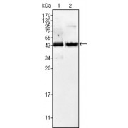 Western blot analysis using AMACR antibody against Jurkat (1) and LNCaP (2) cell lysate.