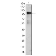 Western blot analysis using BMX antibody against BMX (AA: 138-276) -hIgGFc transfected HEK293 cell lysate.