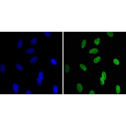 Chromobox Protein Homolog 1 (CBX1) Antibody