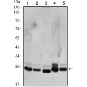 Western blot analysis using CBX1 antibody against Hela (1), COS7 (2), NIH/3T3 (3), A431 (4),and C6 (5) cell lysate.