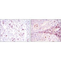 T-cell Surface Glycoprotein CD1a (CD1A) Antibody
