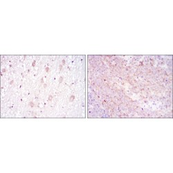 T-cell Surface Glycoprotein CD1a (CD1A) Antibody