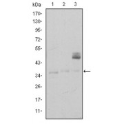 Western blot analysis using CD1A antibody against K562 (1), RAJI (2), and MOLT4 (3) cell lysate.