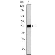 Western blot analysis using CD247 antibody against CD247 (AA: 52-164) -hIgGFc transfected HEK293 cell lysate.