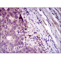 Myeloid Cell Surface Antigen CD33 (CD33) Antibody