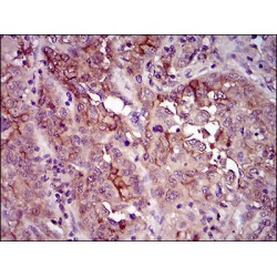 Myeloid Cell Surface Antigen CD33 (CD33) Antibody