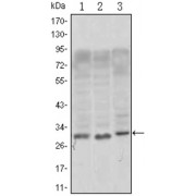Western blot analysis using CD69 antibody against, Jurkat (1), L1210 (2) and TPH-1 (3) cell lysate.