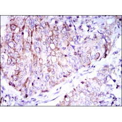 T-Cell Antigen CD7 (CD7) Antibody