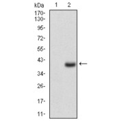 Western blot analysis using CD7 antibody against human CD7 recombinant protein. (Expected MW is 36.6 kDa).