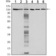 Western blot analysis using CDH1 antibody against LNCAP (1), A431 (2), DU145 (3), PC-3 (4), PC-12 (5) and T47D (6) cell lysate.