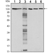 Western blot analysis using CDH1 antibody against LNCAP (1), A431 (2), DU145 (3), PC-3 (4), PC-12 (5) and T47D (6) cell lysate.