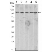 WB analysis of A431 (1), NIH/3T3 (2), HeLa (3), C6 (4) and LNCap (5) cell lysates, using CDH2 antibody.