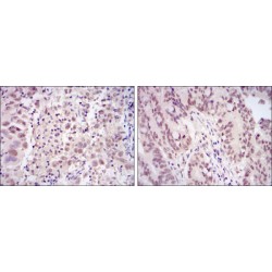 Cyclin-Dependent Kinase 9 (CDK9) Antibody